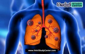 Vetri Study Center Current Affairs - Lung Cancer