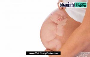Vetri Study Center Current Affairs - Maternal Death